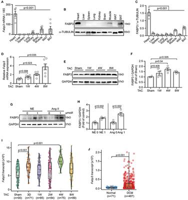 FABP3 Deficiency Exacerbates Metabolic Derangement in Cardiac Hypertrophy and Heart Failure via PPARα Pathway